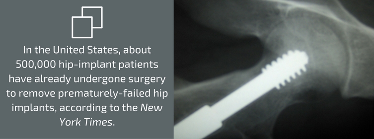 Metal On Metal Hips Implants
